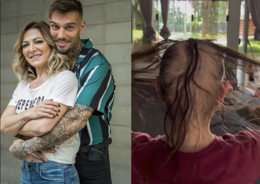 Relato de Karina Lucco destaca impactos da alopecia na autoestima feminina